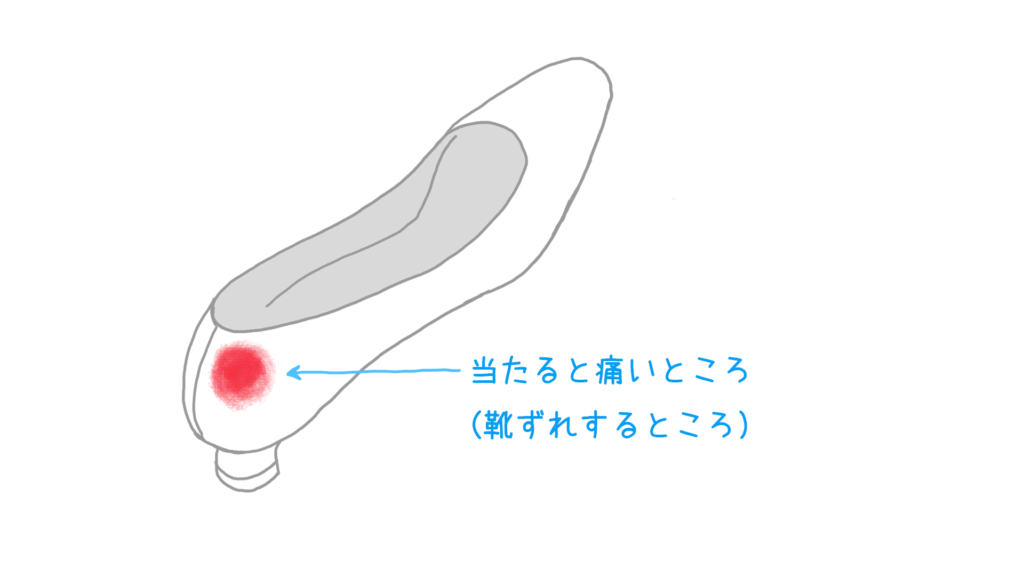 図：かかと部分に赤い印の入ったパンプスイラスト。赤い印に矢印で「当たると痛いところ（靴ずれするところ）」とコメント